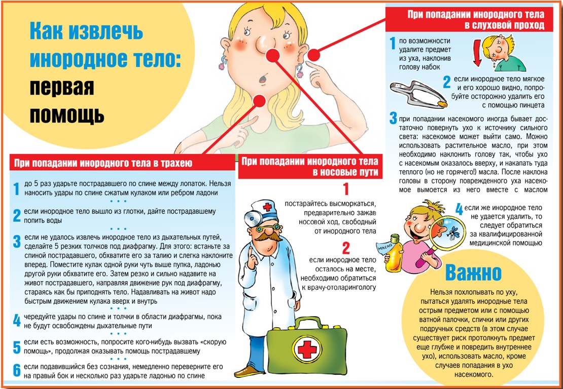 Как извлечь инородное тело